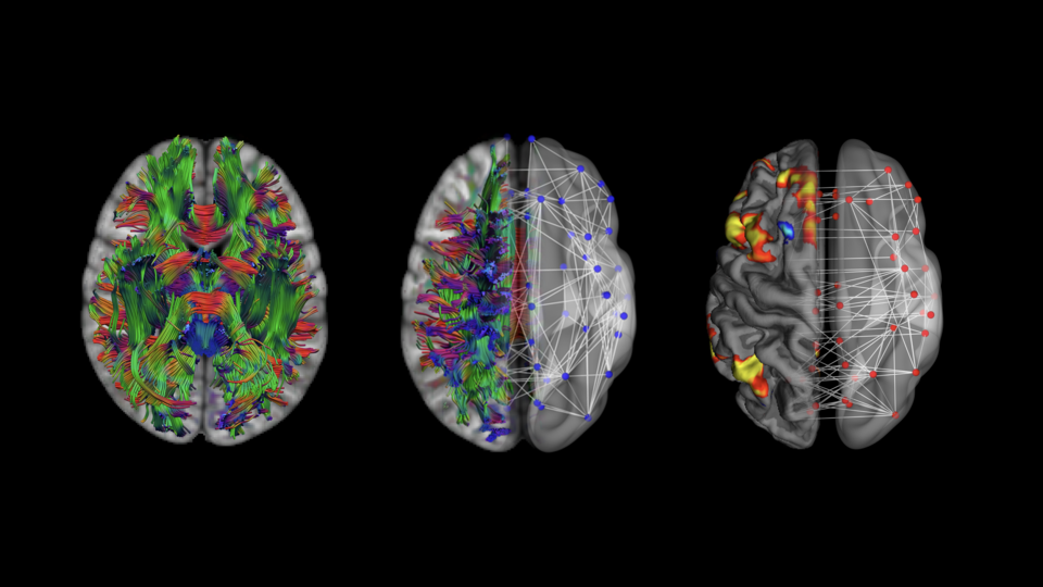 MRI_Facilities